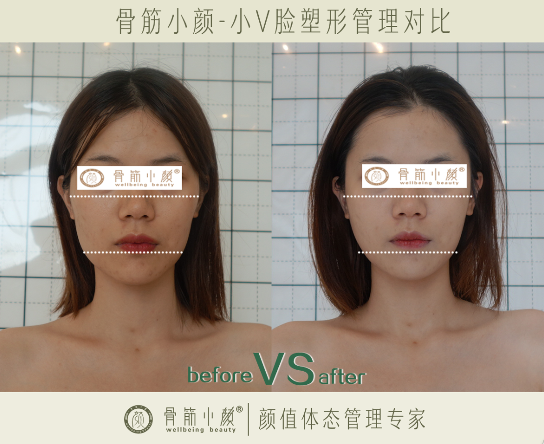 女人脸部皮肤蜕变面部整形整容图片下载 - 觅知网